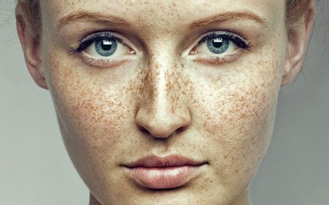 Does lemon juice really get rid of freckles?