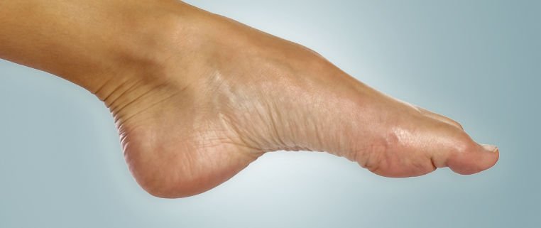 tendonitis in foot