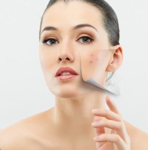 skin with acne