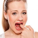 How to get rid of canker sores more than 10 effective methods for adults and kids!