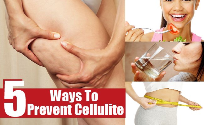 Ways-To-Prevent-Cellulite