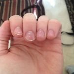 How to get rid of white nails: 3 things you must obligatory do