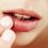 stomatitis
