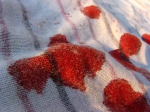 Blood stains on clothes