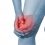 Acute pain in a woman knee. Isolation on a white background