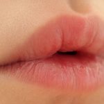5 Steps You Should Take to Treat Chapped Lips Effectively